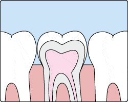Gif showing animated tooth receiving dental sealants in Fort Washington