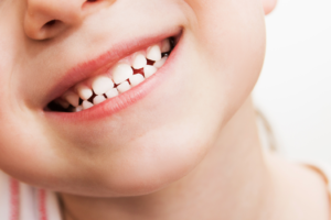 a closeup of a young child smiling